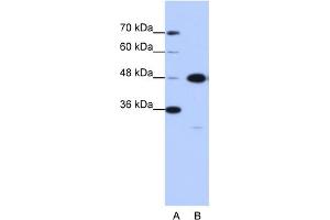 WB Suggested Anti-GTPBP9 Antibody Titration:  0. (OLA1 anticorps  (N-Term))