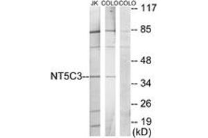 Western blot analysis of extracts from Jurkat/COLO205 cells, using NT5C3 Antibody. (NT5C3 anticorps  (AA 11-60))