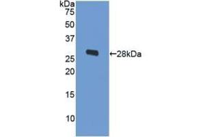 Detection of Recombinant ODC, Human using Polyclonal Antibody to Ornithine Decarboxylase (ODC)