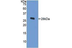Detection of Recombinant ODC, Human using Polyclonal Antibody to Ornithine Decarboxylase (ODC) (ODC1 anticorps  (AA 15-259))
