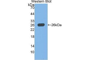 Detection of Recombinant UCHL1, Rat using Polyclonal Antibody to Ubiquitin Carboxyl Terminal Hydrolase L1 (UCHL1) (UCHL1 anticorps  (AA 2-223))