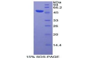 SDS-PAGE analysis of Human DVL3 Protein. (DVL3 Protéine)