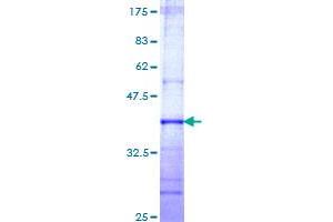 Image no. 1 for 5-Methyltetrahydrofolate-Homocysteine Methyltransferase (MTR) (AA 1094-1203) protein (GST tag) (ABIN1311608)
