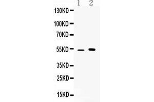 Western blot analysis of CDR2 expression in mouse kidney extract ( Lane 1) and MCF-7 whole cell lysates ( Lane 2).