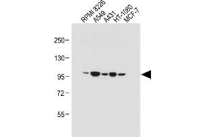 All lanes : Anti-RHBDF2 Antibody (N-term) at 1:1000 dilution Lane 1: RI 8226 whole cell lysate Lane 2: A549 whole cell lysate Lane 3: A431 whole cell lysate Lane 4: HT-1080 whole cell lysate Lane 5: MCF-7 whole cell lysate Lysates/proteins at 20 μg per lane.