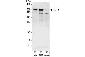 Western Blotting (WB) image for anti-Tet Methylcytosine Dioxygenase 2 (TET2) (AA 100-150) antibody (ABIN7453557)