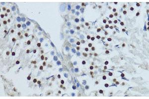 Immunohistochemistry of paraffin-embedded Rat testis using NR1I3 Polyclonal Antibody at dilution of 1:200 (40x lens). (NR1I3 anticorps)