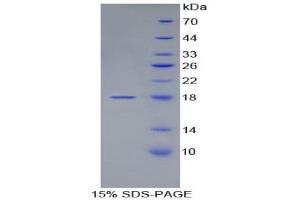 SDS-PAGE (SDS) image for Von Willebrand Factor (VWF) (AA 1498-1665) protein (His tag) (ABIN1879755) (VWF Protein (AA 1498-1665) (His tag))