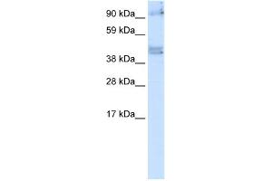 WB Suggested Anti-SIRT2 Antibody   Titration: 5 ug/ml   Positive Control: Fetal Brain (SIRT2 anticorps  (N-Term))