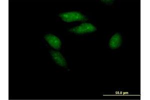 Immunofluorescence of purified MaxPab antibody to PCGF3 on HeLa cell.