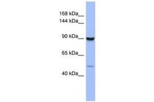 Image no. 1 for anti-Zinc Finger Protein 28 (ZFP28) (AA 791-840) antibody (ABIN6742858) (ZFP28 anticorps  (AA 791-840))