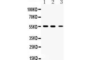 Western blot analysis of Beta III Tubulin expression in rat brian extract ( Lane 1), mouse brain extract ( Lane 2) and HELA whole cell lysates ( Lane 3). (TUBB3 anticorps  (C-Term))