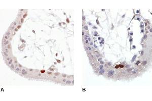 Immunohistochemistry staining of Wild-type p53 expressed in human trophoblast (paraffin-embedded sections).