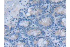DAB staining on IHC-P; Samples: Rat Small intestine Tissue