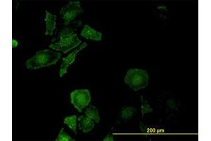 Image no. 2 for anti-Leucine Proline-Enriched Proteoglycan (Leprecan) 1 (LEPRE1) (AA 1-100) antibody (ABIN599294) (LEPRE1 anticorps  (AA 1-100))