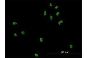 Immunofluorescence of monoclonal antibody to CSE1L on HeLa cell.