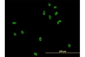 Immunofluorescence of monoclonal antibody to CSE1L on HeLa cell. (Exportin 2 anticorps  (AA 872-971))