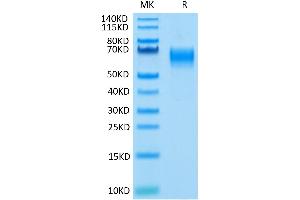 Human IL-1 Rrp2 on Tris-Bis PAGE under reduced condition.