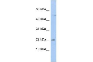 WB Suggested Anti-C19orf25 Antibody Titration:  0. (C19orf25 anticorps  (N-Term))