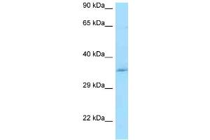 WB Suggested Anti-CCDC117 Antibody Titration: 1. (CCDC117 anticorps  (Middle Region))