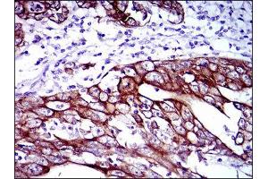 Immunohistochemistry (IHC) image for anti-Keratin 5 (KRT5) antibody (ABIN1845565) (Cytokeratin 5 anticorps)