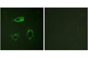 Immunofluorescence analysis of HepG2 cells, using CD18/ITGB2 (Phospho-Thr758) Antibody. (Integrin beta 2 anticorps  (pThr758))