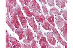 Anti-SERCA1 antibody IHC of human heart.