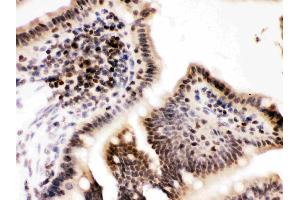 Cyclin T1 was detected in paraffin-embedded sections of mouse intestine tissues using rabbit anti- Cyclin T1 Antigen Affinity purified polyclonal antibody (Catalog # ) at 1 ?