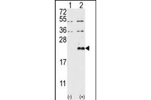 Western blot analysis of DUSP13 (arrow) using DUSP13-M1 Antibody (N-term) (ABIN392875 and ABIN2842283). (DUSP13-M1 (AA 1-30), (N-Term) anticorps)