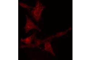 ABIN6275547 staining  Hela cells by IF/ICC. (PPP2R5D anticorps  (C-Term))