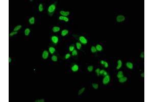 Immunofluorescence staining of Hela cells with ABIN7127301 at 1:37.