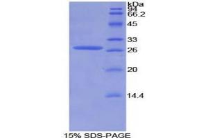 SDS-PAGE analysis of Mouse AXIN Protein. (Axin Protéine)