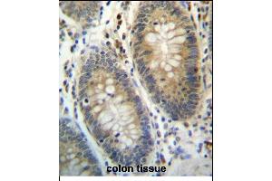 TE Antibody (C-term) (ABIN657175 and ABIN2846306) immunohistochemistry analysis in formalin fixed and paraffin embedded human colon tissue followed by peroxidase conjugation of the secondary antibody and DAB staining. (TEX261 anticorps  (C-Term))