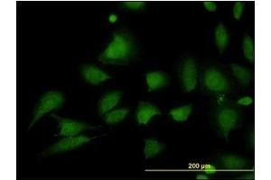 Immunofluorescence (IF) image for anti-Stromal Interaction Molecule 1 (STIM1) (AA 24-686) antibody (ABIN614666)