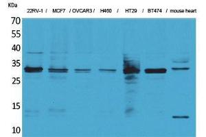 Western Blotting (WB) image for anti-Latexin (LXN) (Internal Region) antibody (ABIN3187682) (Latexin anticorps  (Internal Region))