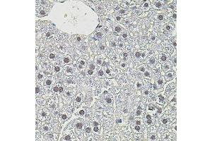 Immunohistochemistry of paraffin-embedded mouse liver using MYC antibody. (c-MYC anticorps)