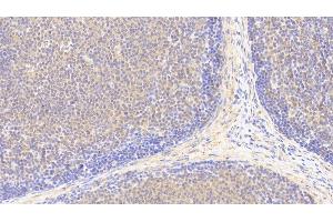 Detection of PLCd4 in Human Lymph node Tissue using Polyclonal Antibody to Phospholipase C Delta 4 (PLCd4)