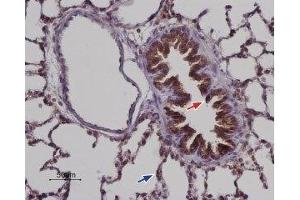 Expression of STIM2 in rat lung - Immunohistochemical staining of paraffin embedded rat lung sections using Anti-STIM2 Antibody (ABIN7043782, ABIN7044028 and ABIN7044029), (1:100).