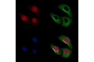 ABIN6262106 and ABIN6273119 staining Hela by IF/ICC. (GSDMD anticorps)