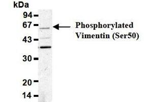 Western Blotting (WB) image for anti-Vimentin (VIM) (pSer50) antibody (ABIN1449160) (Vimentin anticorps  (pSer50))