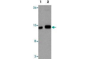 Western blot analysis of IFITM1 in NIH/3T3 cell lysate with IFITM1 polyclonal antibody  at (1) 1 and (2) 2 ug/mL.