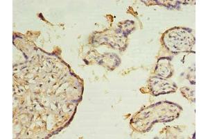 Immunohistochemistry of paraffin-embedded human placenta tissue using ABIN7176101 at dilution of 1:100 (ZMYND19 anticorps  (AA 1-227))