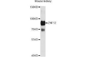 Western blot analysis of extracts of mouse kidney, using ZNF12 Antibody (ABIN6291084) at 1:3000 dilution. (ZNF12 anticorps)