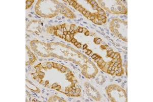 Immunohistochemistry of paraffin-embedded human kidney using IL23R antibody at dilution of 1:200 (x400 lens) (IL23R anticorps)