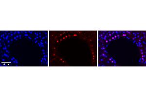 Rabbit Anti-SREBF1 Antibody  AV Formalin Fixed Paraffin Embedded Tissue: Human Liver Tissue Observed Staining: Nucleus in hepatocytes Primary Antibody Concentration: 1:100 Other Working Concentrations: N/A Secondary Antibody: Donkey anti-Rabbit-Cy3 Secondary Antibody Concentration: 1:200 Magnification: 20X Exposure Time: 0.