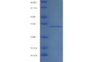 SDS-PAGE (SDS) image for RNA Binding Motif Protein 3 (RBM3) (AA 1-157), (full length) protein (His-SUMO Tag) (ABIN5710219)