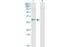 Western Blot analysis of PGAM1 expression in transfected 293T cell line by PGAM1 monoclonal antibody (M01), clone 2G1-A6.