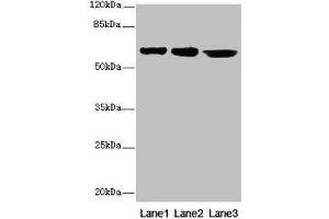 Western blot All lanes: CATSPER2 antibody at 4 μg/mL Lane 1: Jurkat whole cell lysate Lane 2: HepG2 whole cell lysate Lane 3: 293T whole cell lysate Secondary Goat polyclonal to rabbit IgG at 1/10000 dilution Predicted band size: 63, 62, 49, 24 kDa Observed band size: 63 kDa (CATSPER2 anticorps  (AA 5-112))