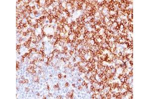 IHC testing of human tonsil stained with CD45RO antibody (UCHL-1). (CD45RO anticorps)