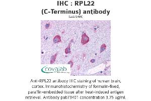 Image no. 1 for anti-Ribosomal Protein L22 (RPL22) (C-Term) antibody (ABIN1738940) (RPL22 anticorps  (C-Term))